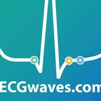 Ecg Waves